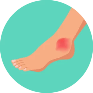 Foot and ankle pain icon
